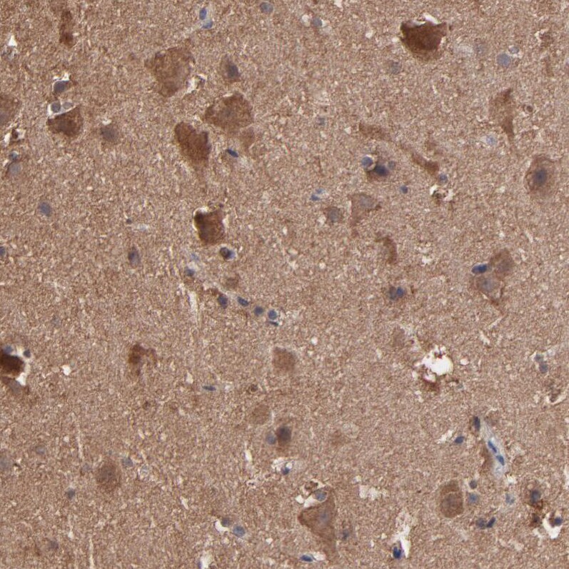 TANGO2 Antibody - BSA Free Immunohistochemistry-Paraffin: TANGO2 Antibody - BSA Free [NBP1-84095]