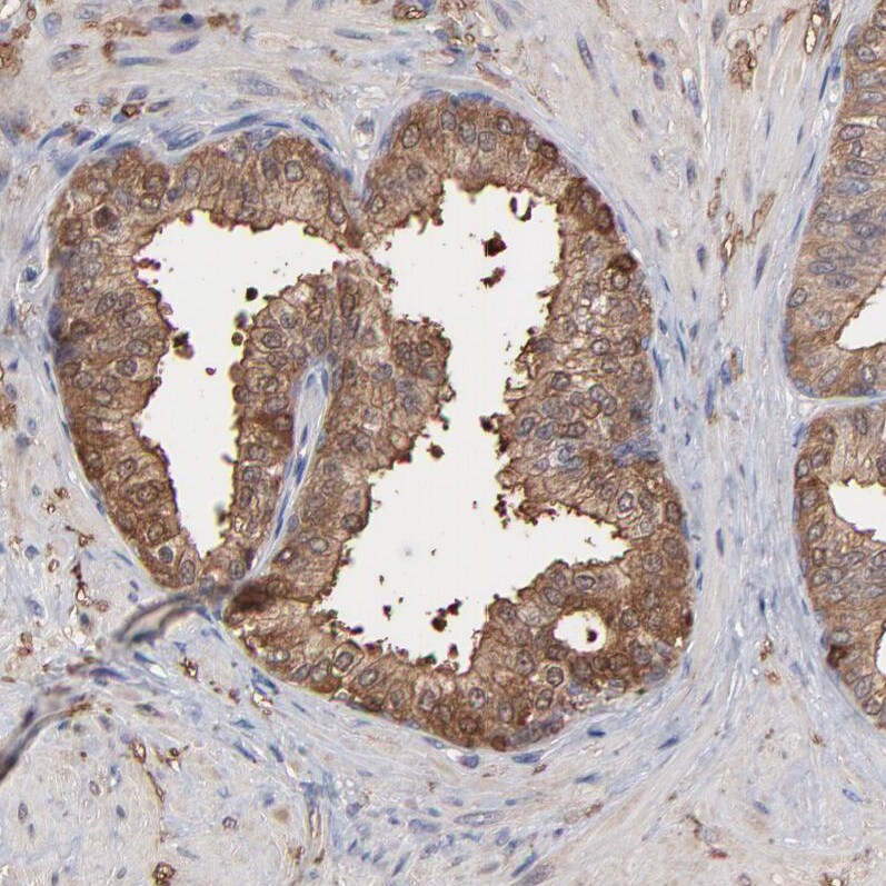 TANGO2 Antibody - BSA Free Immunohistochemistry-Paraffin: TANGO2 Antibody - BSA Free [NBP1-84095]