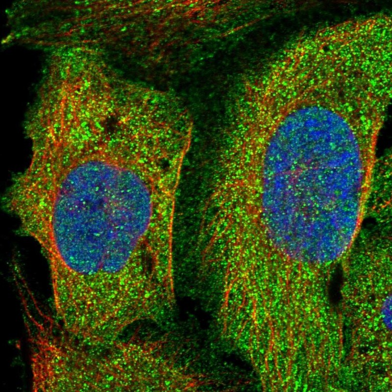 PLEKHO2 Antibody - BSA Free Immunocytochemistry/ Immunofluorescence: PLEKHO2 Antibody [NBP1-84101]