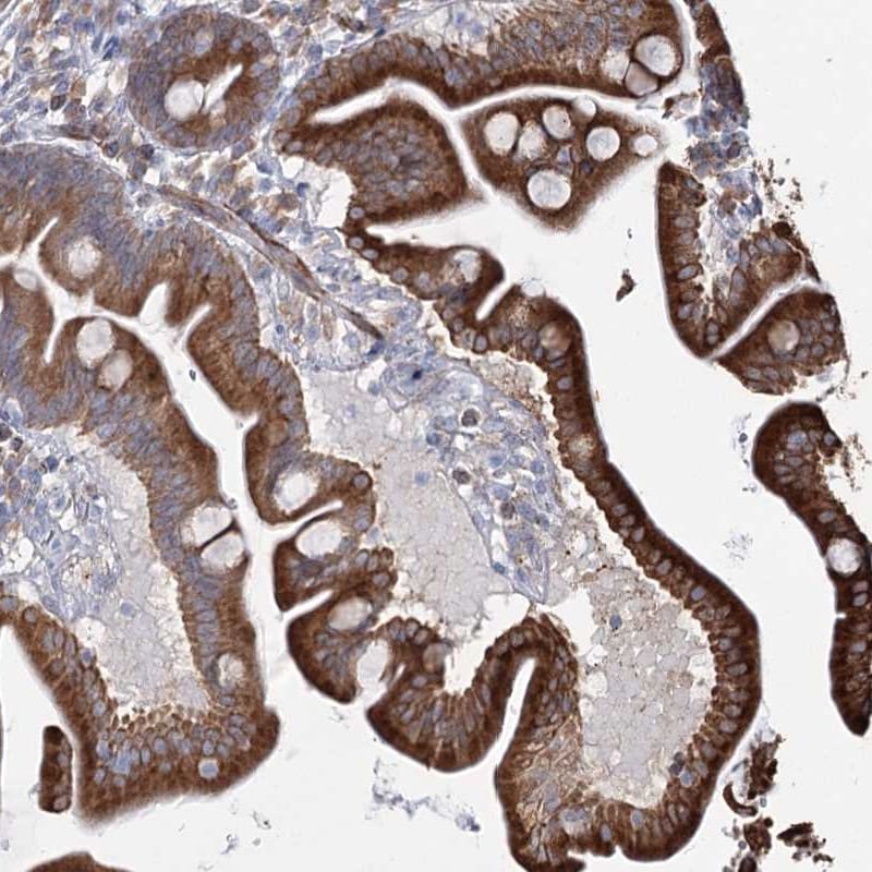 ZCCHC9 Antibody - BSA Free Immunohistochemistry-Paraffin: ZCCHC9 Antibody [NBP1-84102]