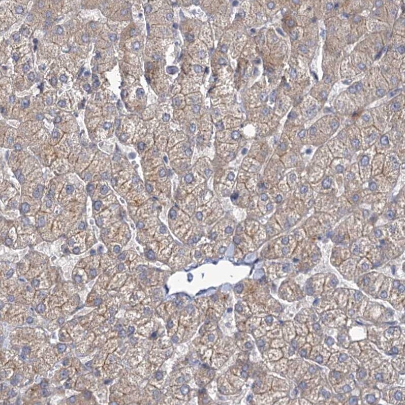 MBLAC2 Antibody - BSA Free Immunohistochemistry-Paraffin: MBLAC2 Antibody - BSA Free [NBP1-84106]