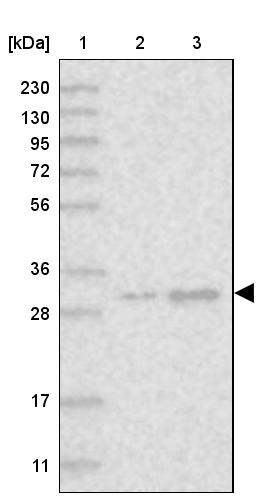 MBLAC2 Antibody - BSA Free Western Blot: MBLAC2 Antibody - BSA Free [NBP1-84106]