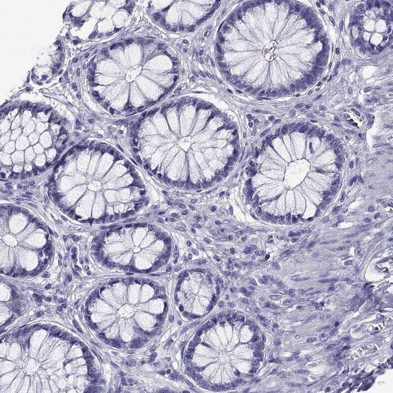 AAK1 Antibody - BSA Free Immunohistochemistry-Paraffin: AAK1 Antibody - BSA Free [NBP1-84110]