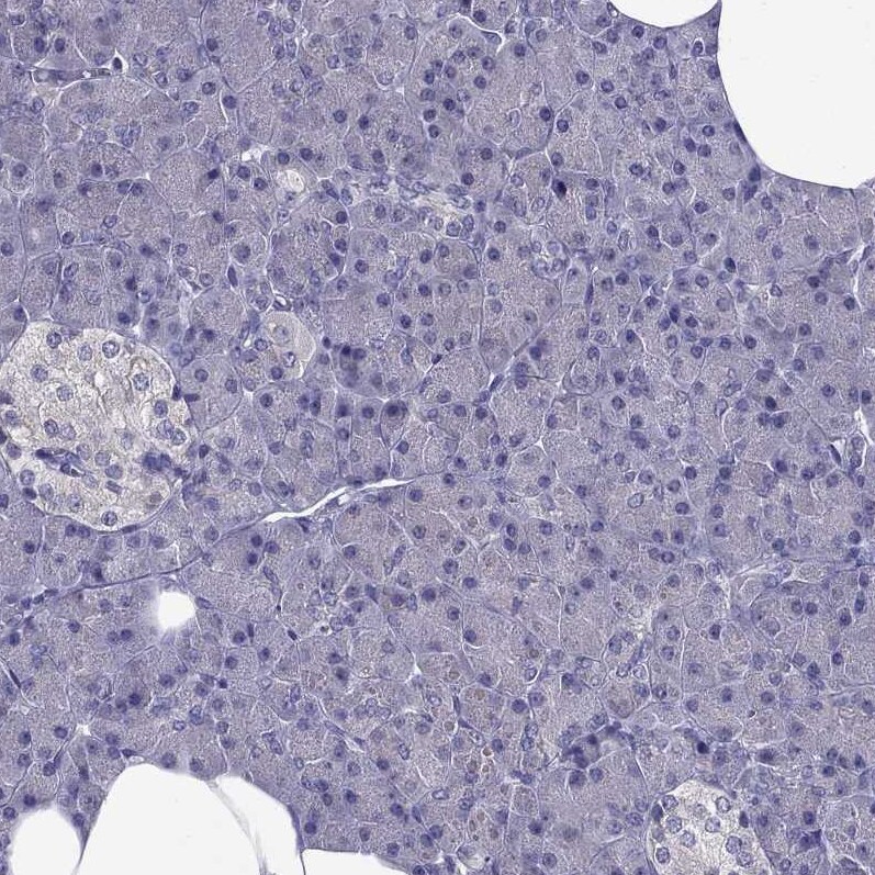 AAK1 Antibody - BSA Free Immunohistochemistry-Paraffin: AAK1 Antibody - BSA Free [NBP1-84110]