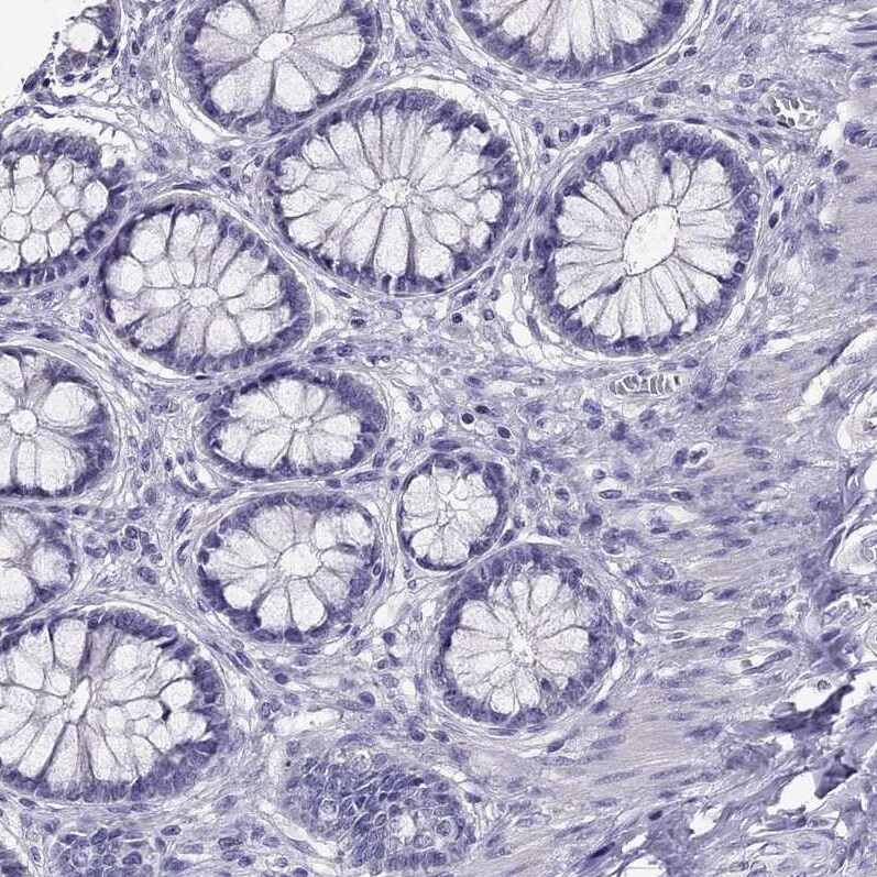 AAK1 Antibody - BSA Free Immunohistochemistry-Paraffin: AAK1 Antibody - BSA Free [NBP1-84111]