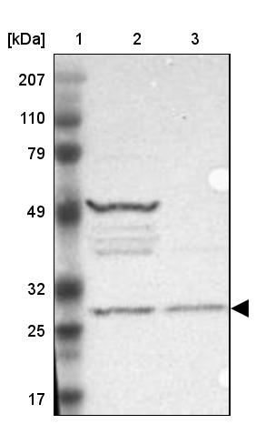 FAM109B Antibody - BSA Free Western Blot: FAM109B Antibody - BSA Free [NBP1-84112]