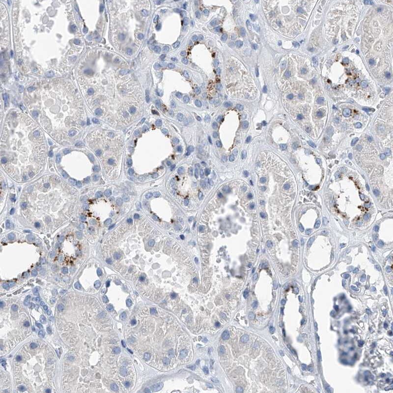 Zinc finger protein 772 Antibody - BSA Free Immunohistochemistry-Paraffin: Zinc finger protein 772 Antibody [NBP1-84113]