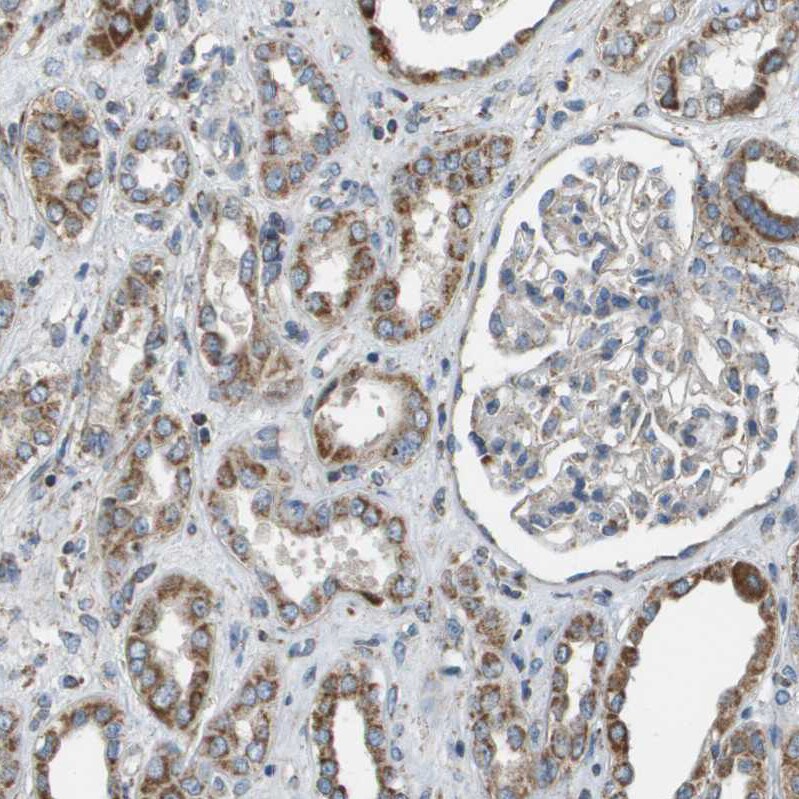 NRK Antibody - BSA Free Immunohistochemistry-Paraffin: NRK Antibody - BSA Free [NBP1-84121]