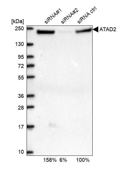 ATAD2 Antibody - BSA Free Western Blot: ATAD2 Antibody - BSA Free [NBP1-84123]