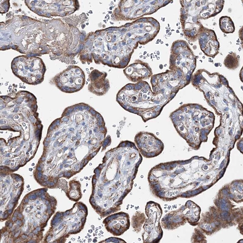SPAG16 Antibody - BSA Free Immunohistochemistry-Paraffin: SPAG16 Antibody - BSA Free [NBP1-84124]