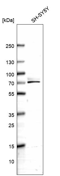 SPAG16 Antibody - BSA Free Western Blot: SPAG16 Antibody - BSA Free [NBP1-84124]