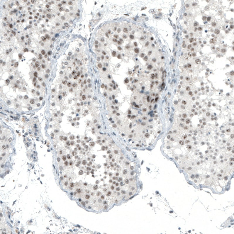 MED20 Antibody - BSA Free Immunohistochemistry-Paraffin: MED20 Antibody [NBP1-84140]