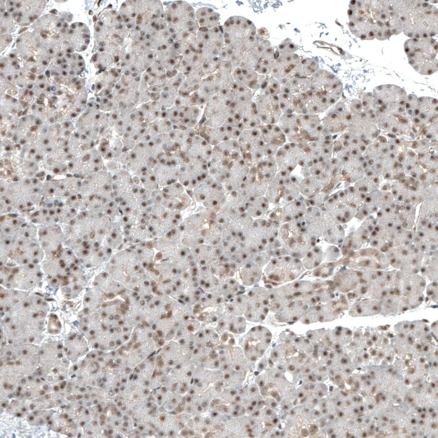 MED20 Antibody - BSA Free Immunohistochemistry-Paraffin: MED20 Antibody [NBP1-84140]