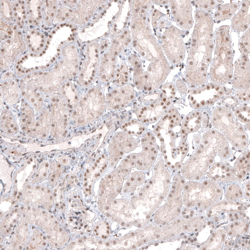 MED20 Antibody - BSA Free Immunohistochemistry-Paraffin: MED20 Antibody [NBP1-84140]