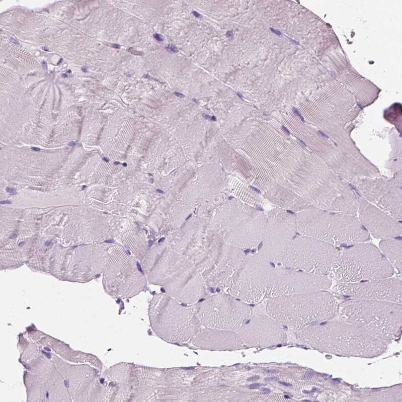 DAK Antibody - BSA Free Immunohistochemistry-Paraffin: DAK Antibody - BSA Free [NBP1-84142]
