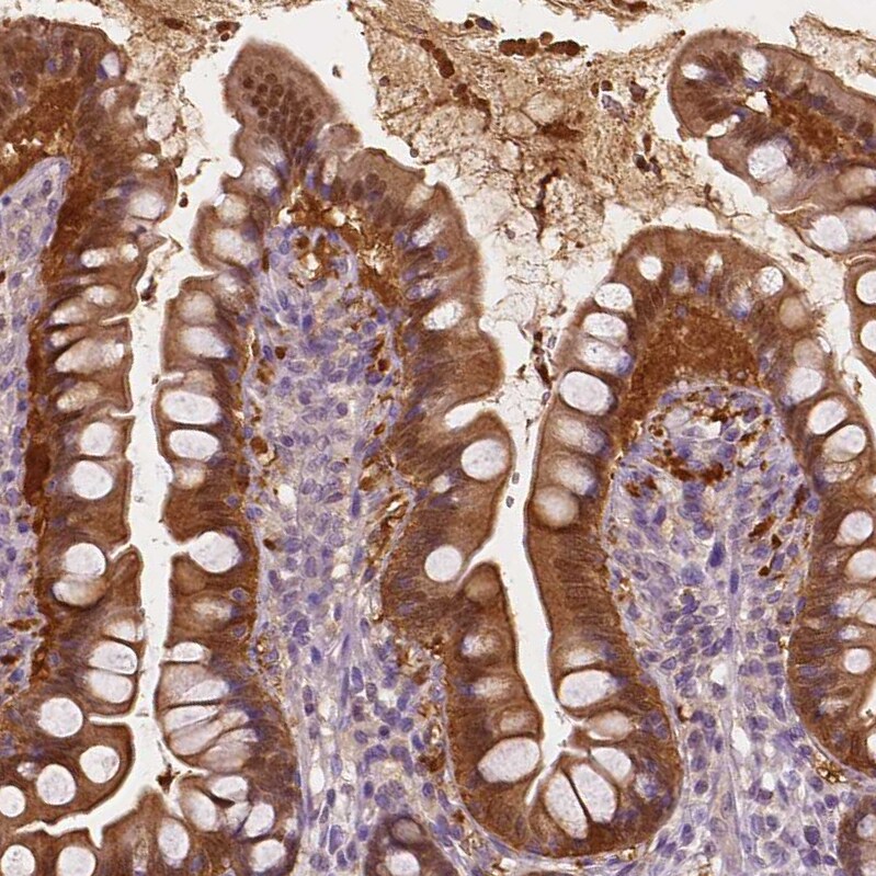 DAK Antibody - BSA Free Immunohistochemistry-Paraffin: DAK Antibody - BSA Free [NBP1-84142]