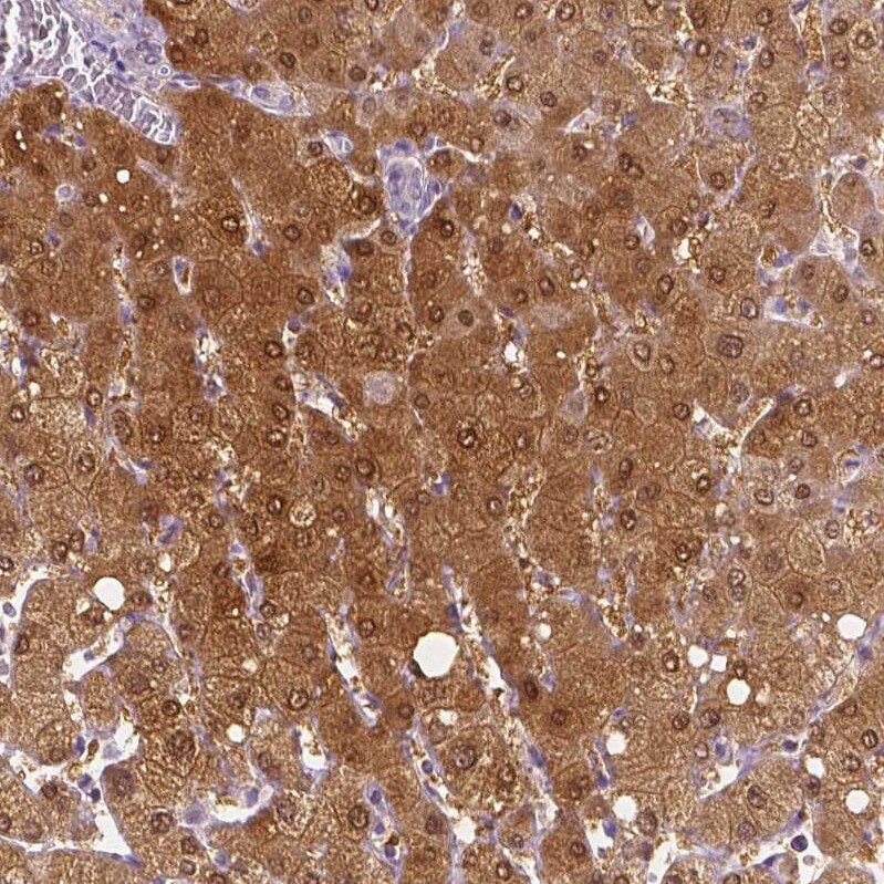 DAK Antibody - BSA Free Immunohistochemistry-Paraffin: DAK Antibody - BSA Free [NBP1-84142]