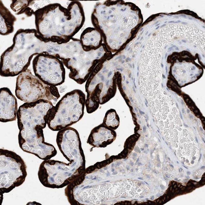 KIF1-binding protein Antibody - BSA Free Immunohistochemistry-Paraffin: KIF1-binding protein Antibody - BSA Free [NBP1-84143]