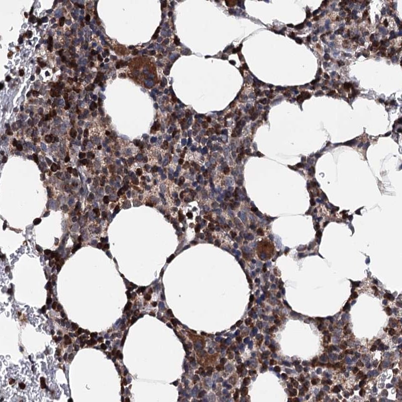 FGFR1OP2 Antibody - BSA Free Immunohistochemistry-Paraffin: FGFR1OP2 Antibody [NBP1-84148]