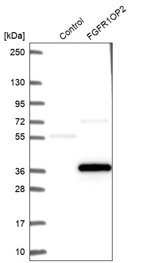 FGFR1OP2 Antibody - BSA Free Western Blot: FGFR1OP2 Antibody - BSA Free [NBP1-84149]