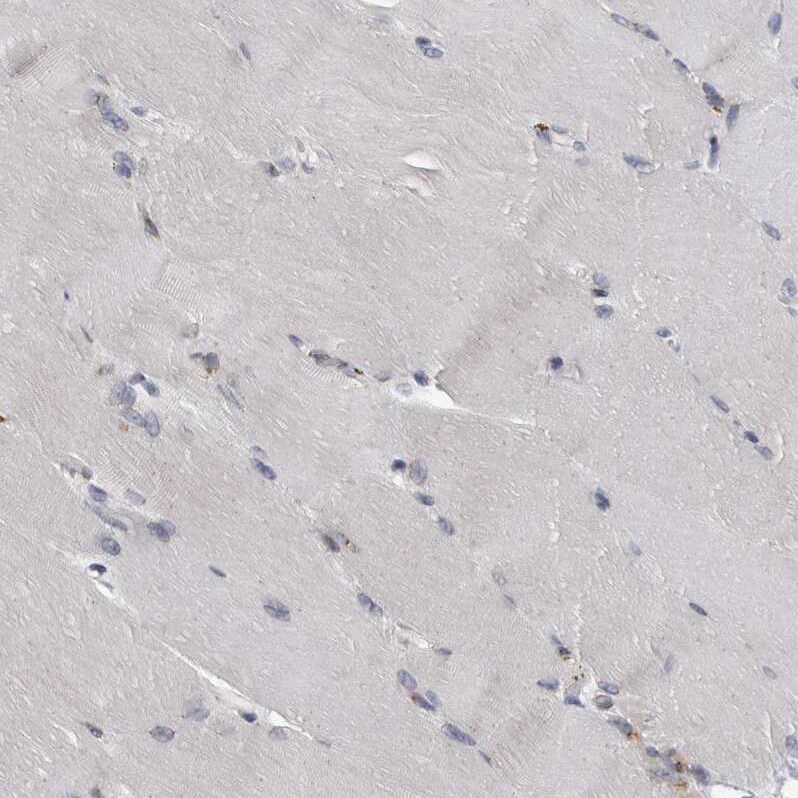 LMAN2L Antibody - BSA Free Immunohistochemistry-Paraffin: LMAN2L Antibody - BSA Free [NBP1-84152]