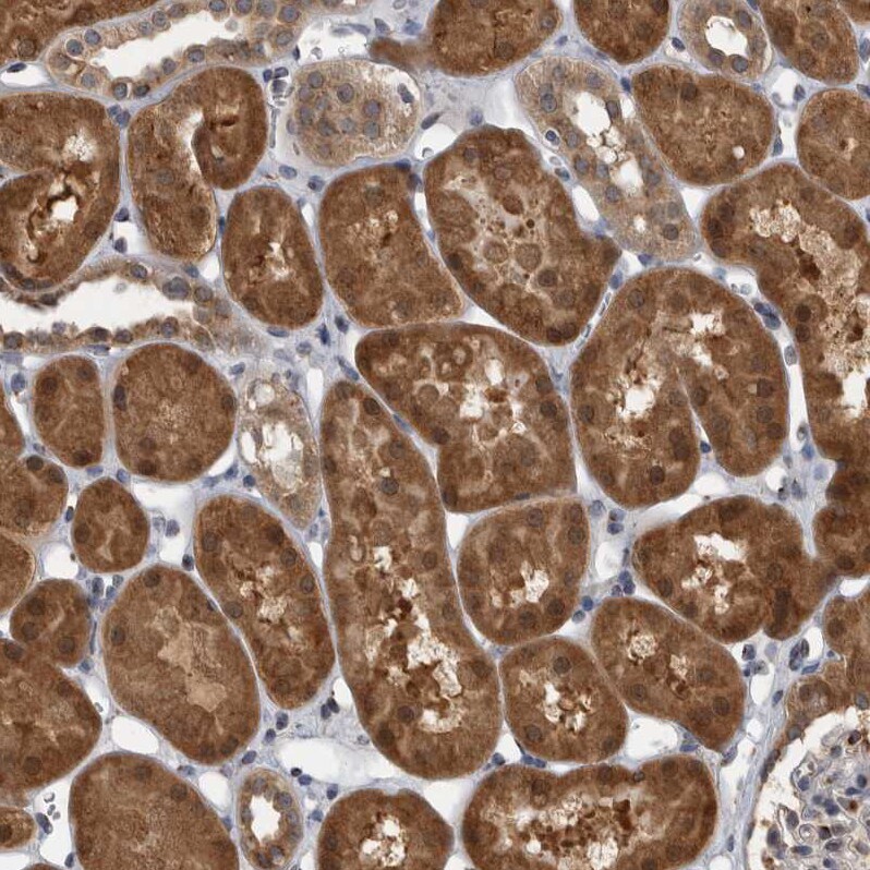 LMAN2L Antibody - BSA Free Immunohistochemistry-Paraffin: LMAN2L Antibody - BSA Free [NBP1-84152]
