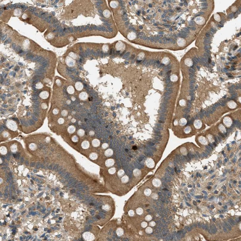 PTPN23 Antibody - BSA Free Immunohistochemistry-Paraffin: PTPN23 Antibody - BSA Free [NBP1-84158]