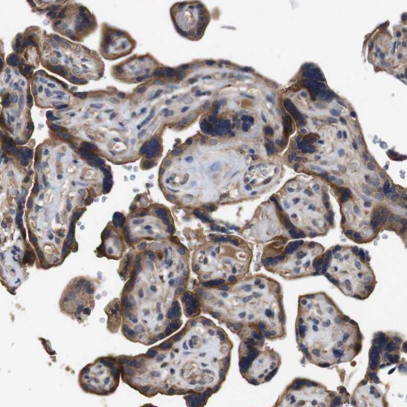 ARHGAP24 Antibody - BSA Free Immunohistochemistry-Paraffin: ARHGAP24 Antibody - BSA Free [NBP1-84161]