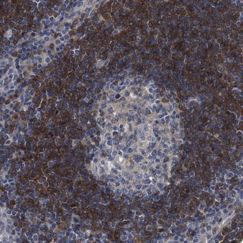 ARHGAP24 Antibody - BSA Free Immunohistochemistry-Paraffin: ARHGAP24 Antibody - BSA Free [NBP1-84161]