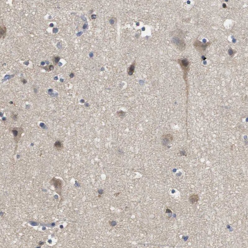 ARHGAP24 Antibody - BSA Free Immunohistochemistry-Paraffin: ARHGAP24 Antibody - BSA Free [NBP1-84161]