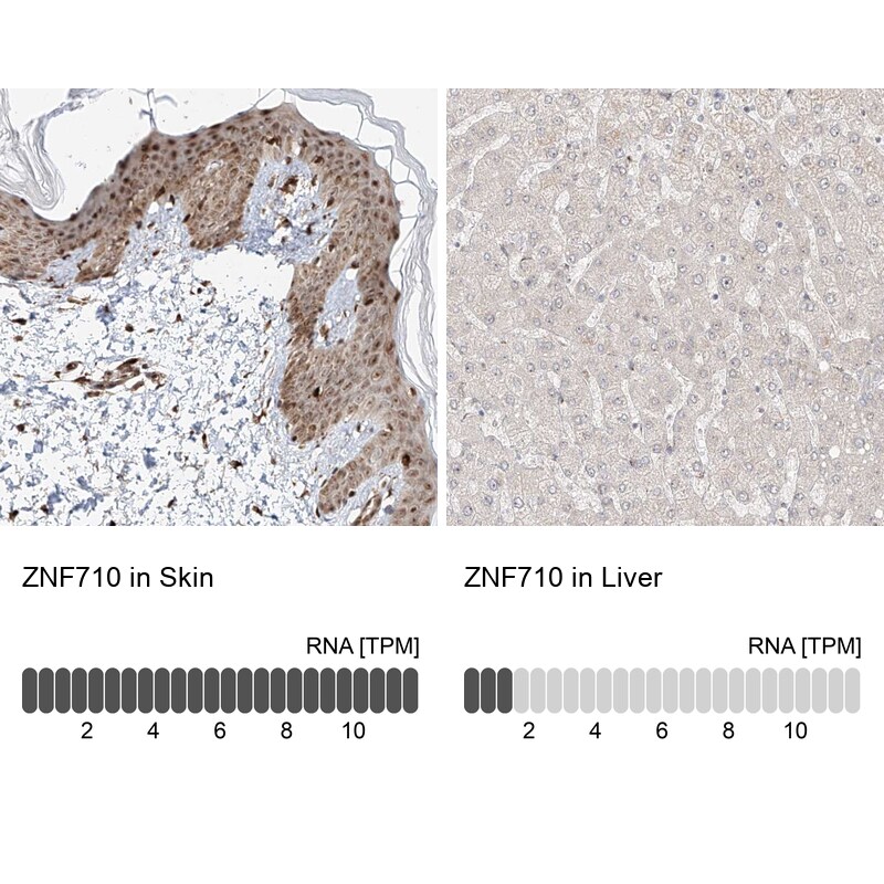 ZNF710 Antibody - BSA Free Immunohistochemistry-Paraffin: ZNF710 Antibody [NBP1-84166]