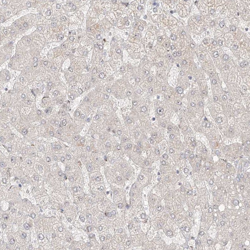 ZNF710 Antibody - BSA Free Immunohistochemistry-Paraffin: ZNF710 Antibody [NBP1-84166]