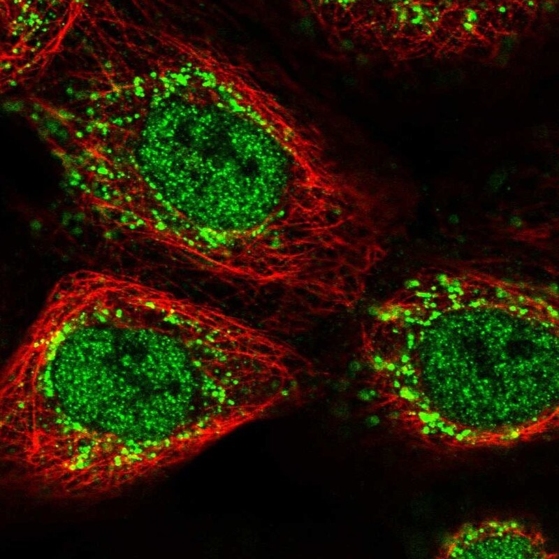 ZNF710 Antibody - BSA Free Immunocytochemistry/ Immunofluorescence: ZNF710 Antibody - BSA Free [NBP1-84166]