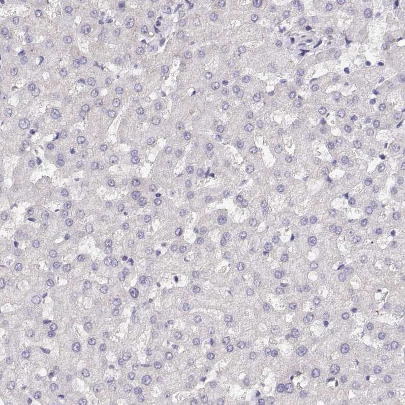 NUT Antibody - BSA Free Immunohistochemistry-Paraffin: NUT Antibody [NBP1-84176]