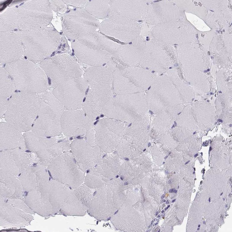 NUT Antibody - BSA Free Immunohistochemistry-Paraffin: NUT Antibody [NBP1-84176]