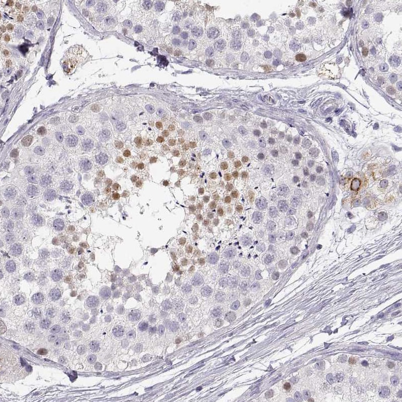 NUT Antibody - BSA Free Immunohistochemistry-Paraffin: NUT Antibody [NBP1-84176]