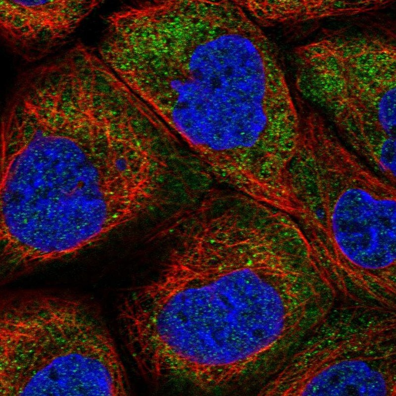 LARP2 Antibody - BSA Free Immunocytochemistry/ Immunofluorescence: LARP2 Antibody [NBP1-84184]
