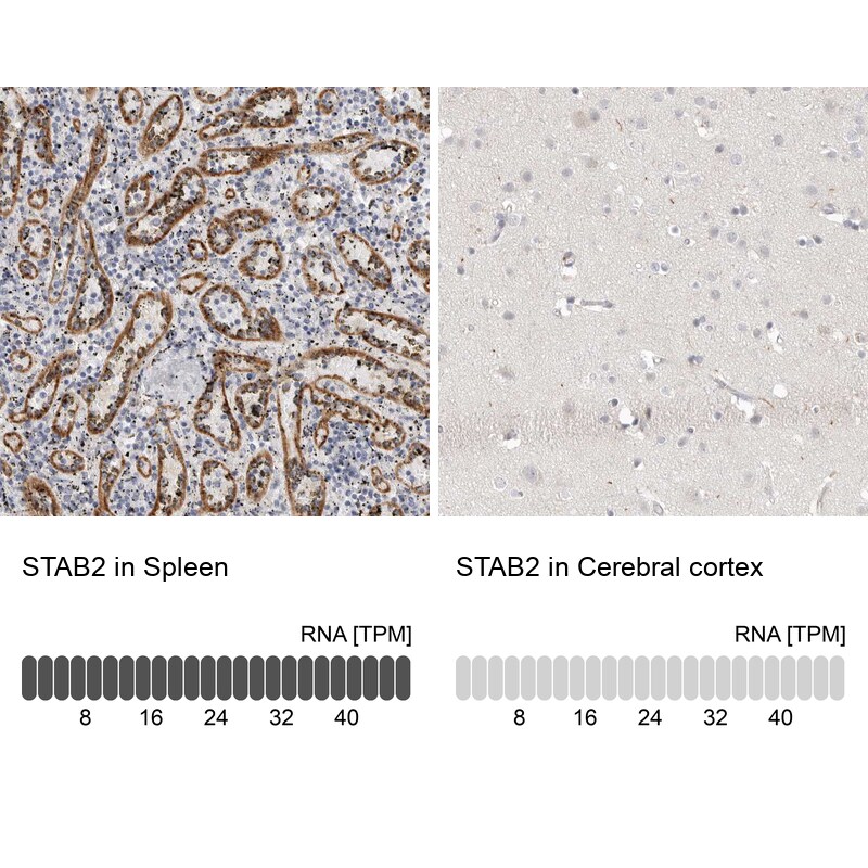 Stabilin-2 Antibody - BSA Free Immunohistochemistry-Paraffin: Stabilin-2 Antibody [NBP1-84197]