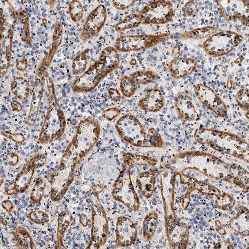 Stabilin-2 Antibody - BSA Free Immunohistochemistry-Paraffin: Stabilin-2 Antibody [NBP1-84197]
