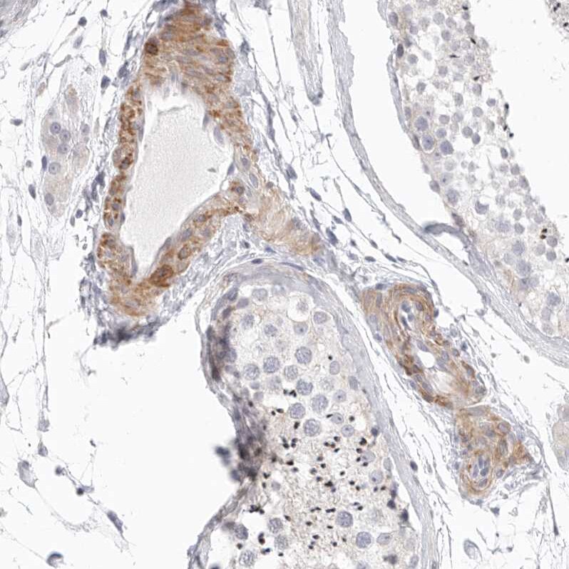 Stabilin-2 Antibody - BSA Free Immunohistochemistry-Paraffin: Stabilin-2 Antibody [NBP1-84197]