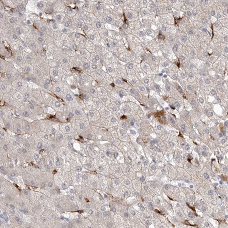 Stabilin-2 Antibody - BSA Free Immunohistochemistry-Paraffin: Stabilin-2 Antibody [NBP1-84197]