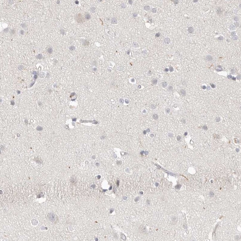 Stabilin-2 Antibody - BSA Free Immunohistochemistry-Paraffin: Stabilin-2 Antibody [NBP1-84197]