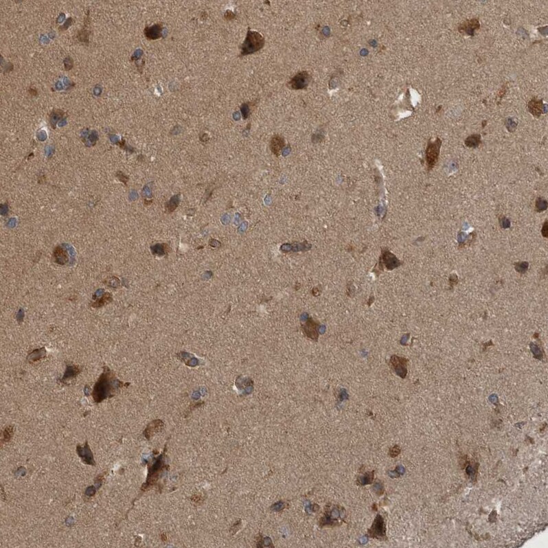 RAB3GAP2 Antibody - BSA Free Immunohistochemistry-Paraffin: RAB3GAP2 Antibody - BSA Free [NBP1-84198]