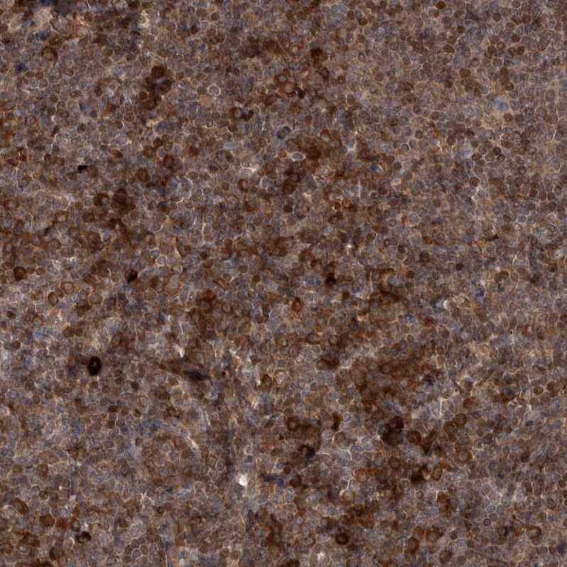 RAB3GAP2 Antibody - BSA Free Immunohistochemistry-Paraffin: RAB3GAP2 Antibody - BSA Free [NBP1-84198]