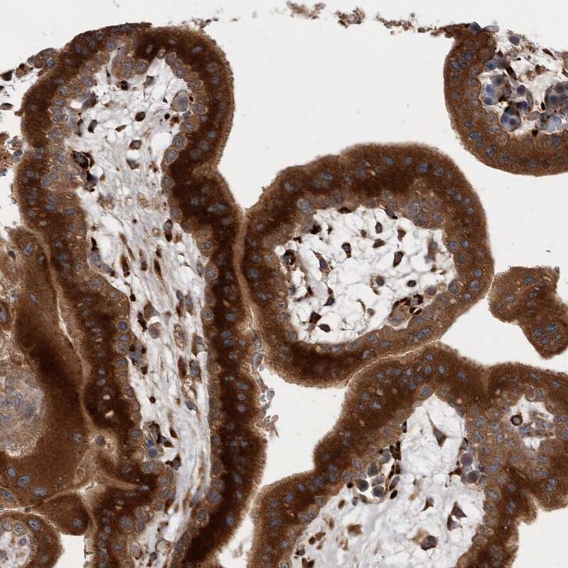 RAB3GAP2 Antibody - BSA Free Immunohistochemistry-Paraffin: RAB3GAP2 Antibody - BSA Free [NBP1-84198]