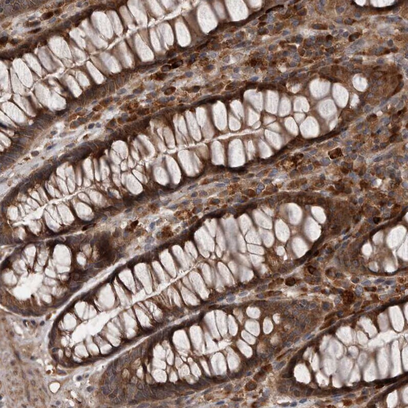 RAB3GAP2 Antibody - BSA Free Immunohistochemistry-Paraffin: RAB3GAP2 Antibody - BSA Free [NBP1-84198]