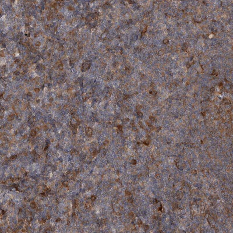 RAB3GAP2 Antibody - BSA Free Immunohistochemistry-Paraffin: RAB3GAP2 Antibody - BSA Free [NBP1-84199]