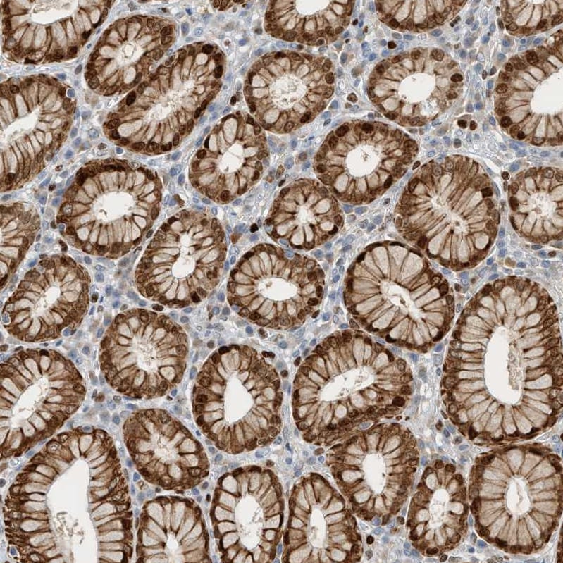 SH3D19 Antibody - BSA Free Immunohistochemistry-Paraffin: SH3D19 Antibody - BSA Free [NBP1-84203]