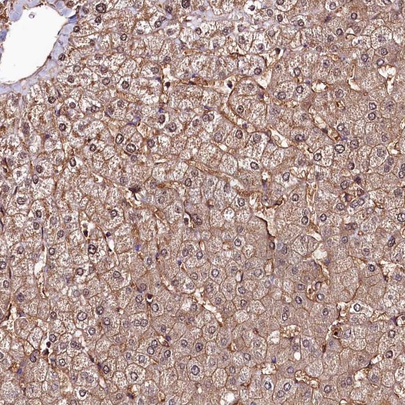 ANO6 Antibody - BSA Free Immunohistochemistry-Paraffin: ANO6 Antibody - BSA Free [NBP1-84207]