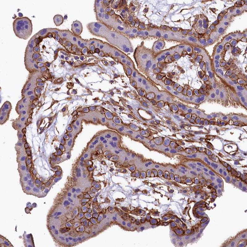 ANO6 Antibody - BSA Free Immunohistochemistry-Paraffin: ANO6 Antibody - BSA Free [NBP1-84207]